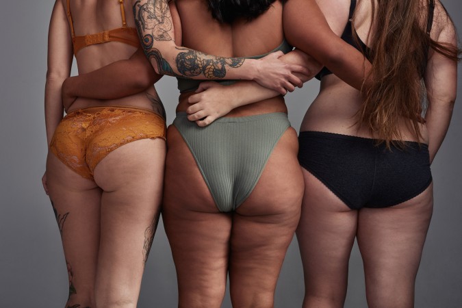 Tipologie di cellulite